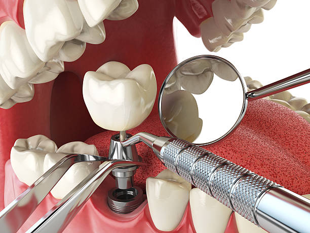 Best Emergency Treatment for Toothache in Corning, IA