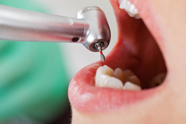 Best After-Hours Emergency Dentist in Corning, IA